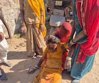 Jalore News: In a land dispute, nephew attacked aunt with a knife and cut her nose, woman seriously injured