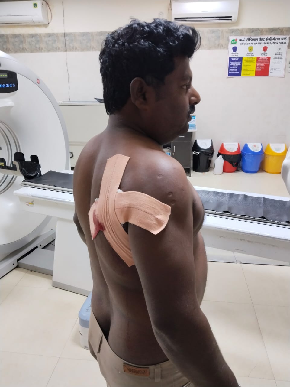 The bullet hit the shoulder of the person in the field