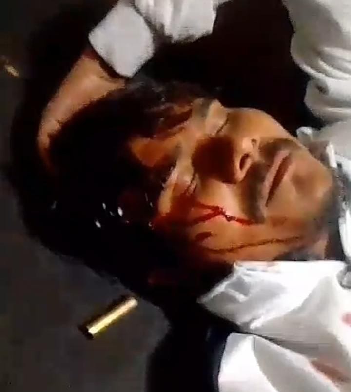Miscreants riding a car shot Sarerah Ward Boy with a pistol, admitted