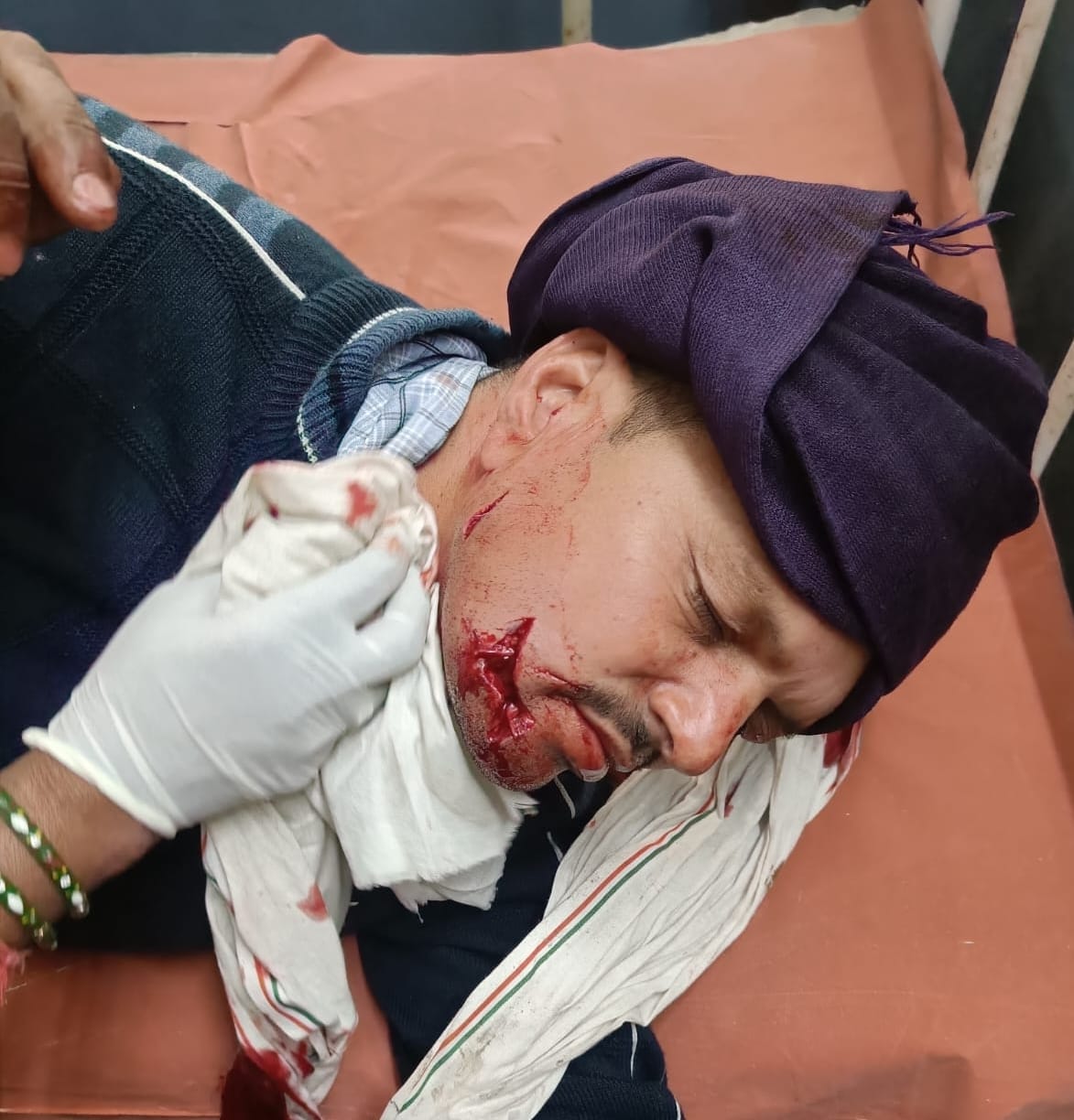 Farmer injured in leopard attack, referred to higher centre