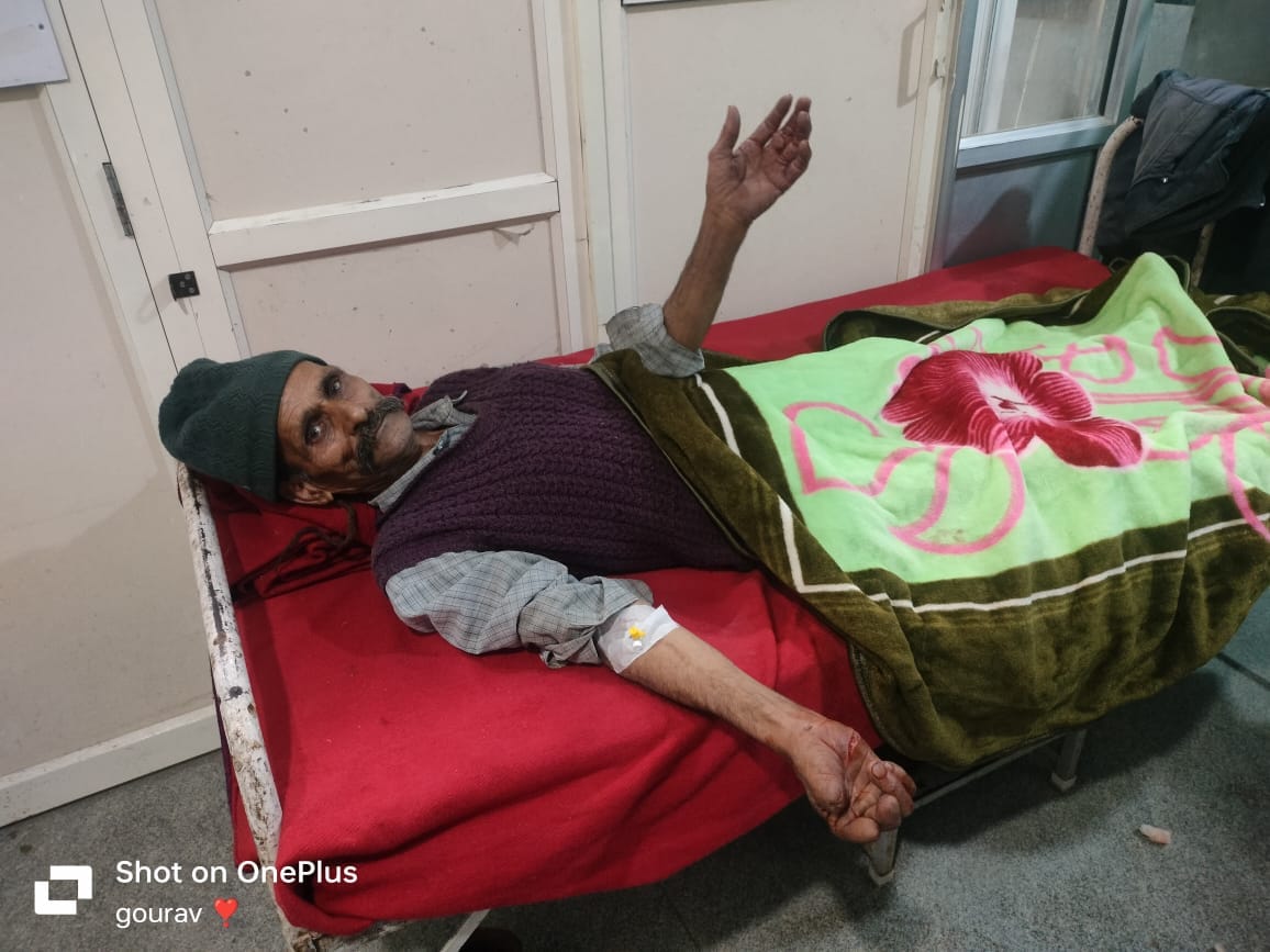 Man injured in monkey attack, admitted to hospital