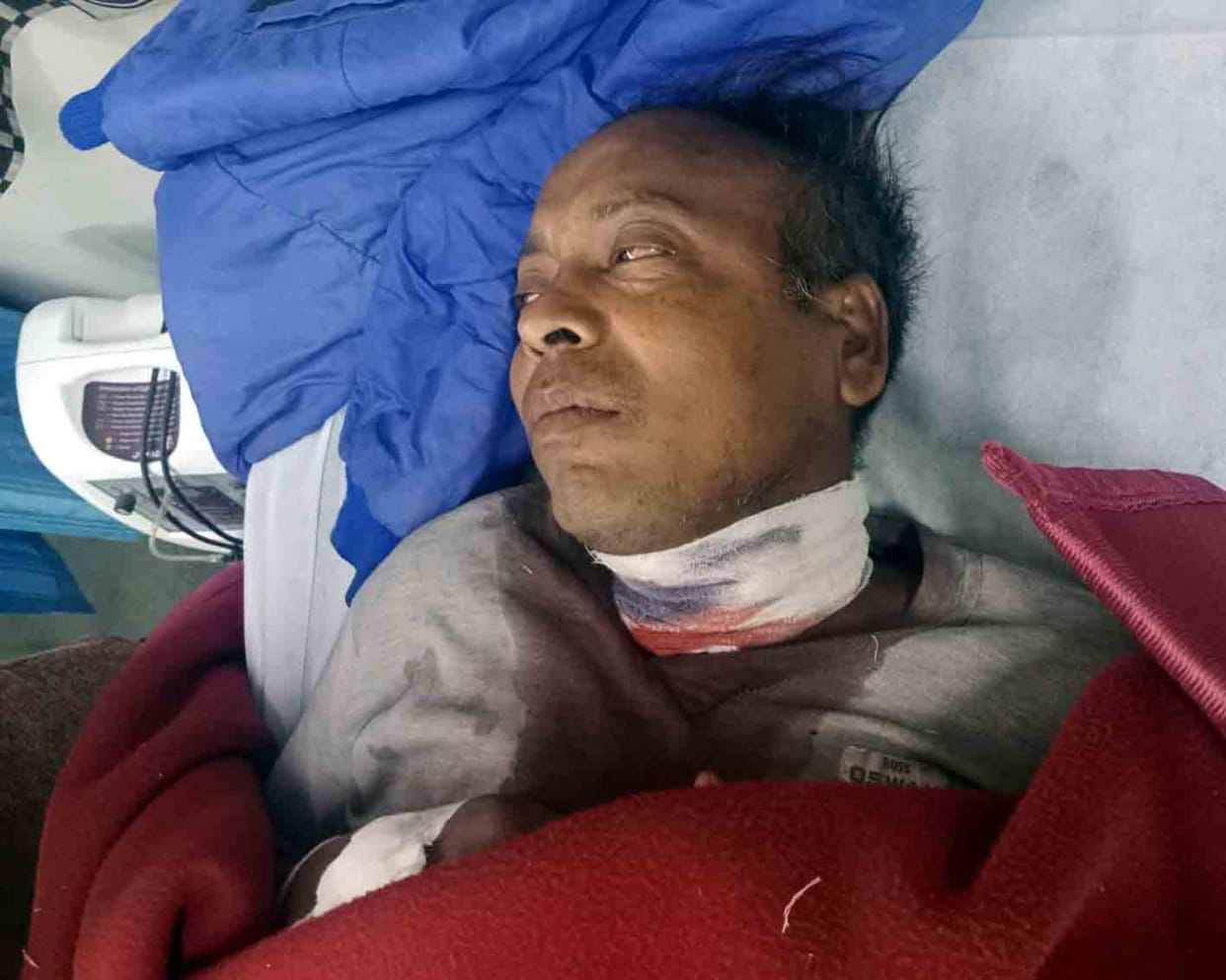 Young man's neck cut by electric wire passing through roof, condition critical