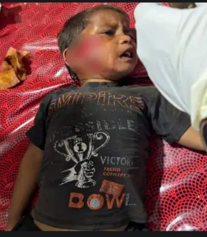 घायल बच्ची
