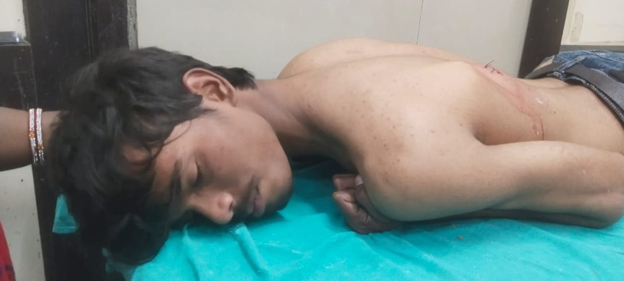 Young man playing gilli danda stabbed, 10 stitches required