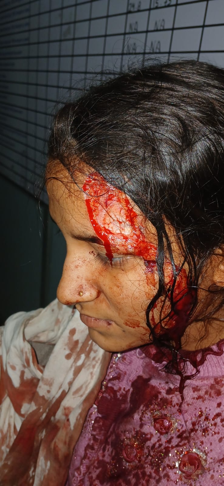 Father and son attack daughter fatally for refusing to lend eggs