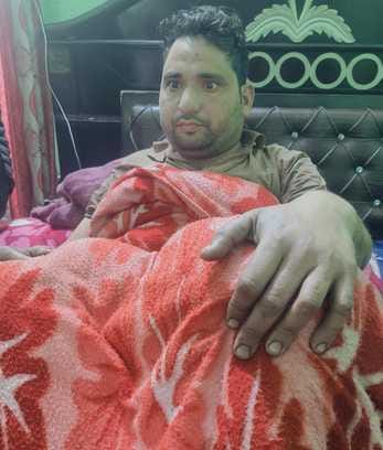 Electricity was turned on despite shutdown, employee burnt due to electric current