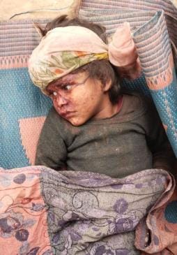 Drunk father beat his four year old daughter, banged her head against the wall, condition critical