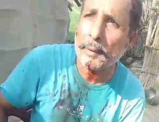 When the leopard attacked, the villager fought back.