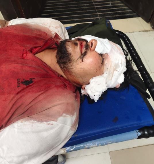 Businessman shot at in hotel, chain looted when he survived
