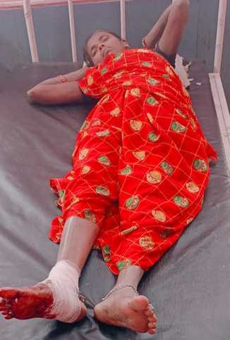 Woman's leg injured after being hit by Chinese Manjha, admitted to CHC