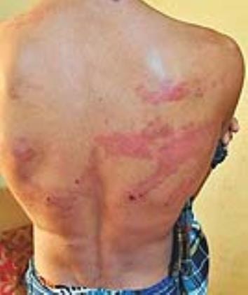 Student taken hostage, beaten, money and phone snatched