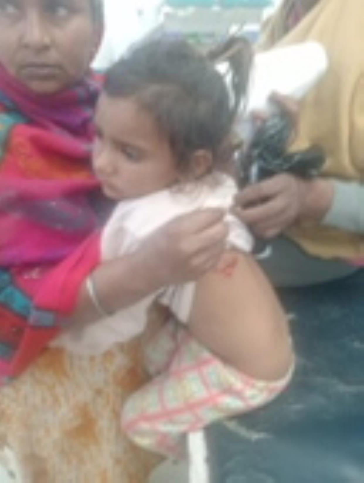 Dog attacks four year old girl and passerby
