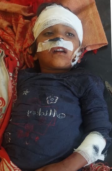 A dog attacked a girl in Padali Mandu