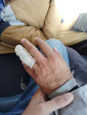 Attack on the team which went to catch electricity theft