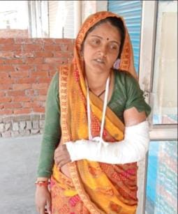 In a dispute between children, sticks were used, a woman's hand was broken
