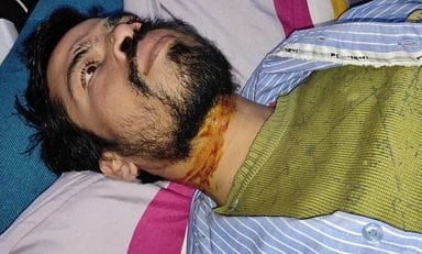 Scooty riding youth's throat cut with a Chinese manja