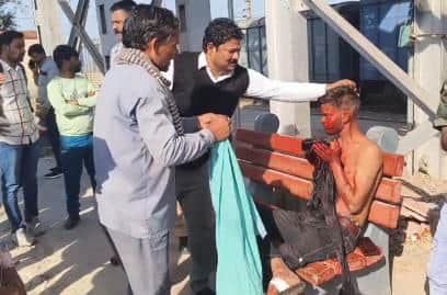 घायल युवक का उपचार करते चिकित्सक 