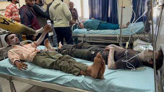 Fire broke out due to opening of gas cylinder pipe in Chaat House in Nangal, four burnt