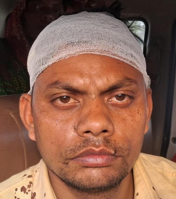Public service center operator beaten with stick and looted Rs 3.81 lakh