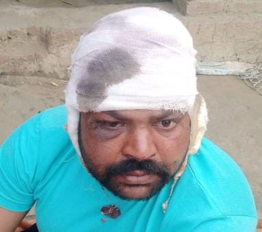Leopard attacks bike riders, two injured