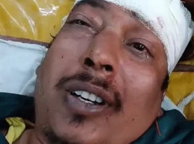 कार की टक्कर से घायल लोग