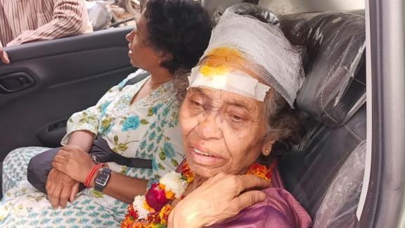 amerika se aaeen kathaavaachak kee bua par bandar ne kiya hamala, ghaayal