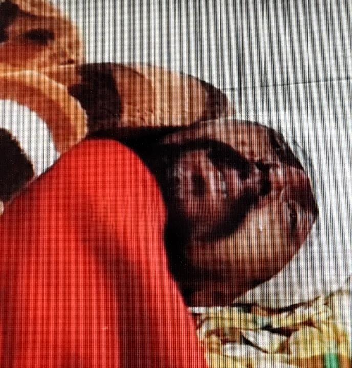 A young man who had come to meet a woman was held hostage and attacked with a weapon, his finger cut off.