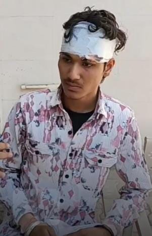 160 rupees snatched by breaking the head of a young man