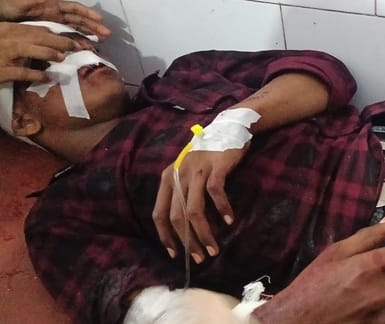 Three students returning after giving the exam were hit by a car and seriously injured