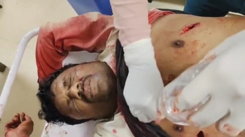 Chhindwara News: Two brothers along with their friends killed a young man over a trivial matter