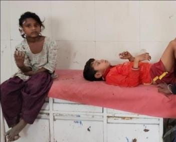 Explosion occurred during magic show, two children got burnt