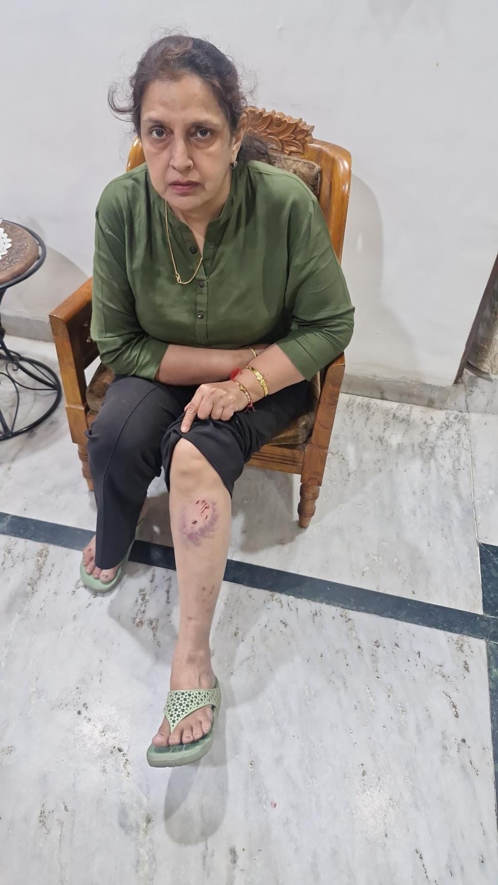Woman bitten by dog, anti-rabies vaccine not available in civil hospital