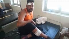 sidhi news : Road accident in Sidhi district, auto collision, 6 people injured