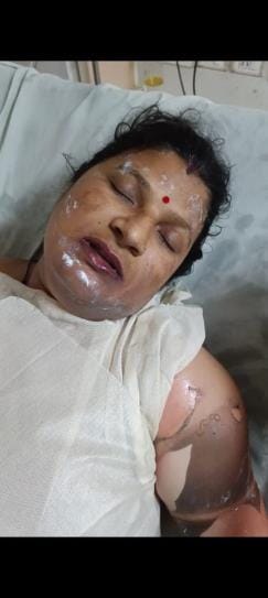 mainpuri news kishni wife burned alive
