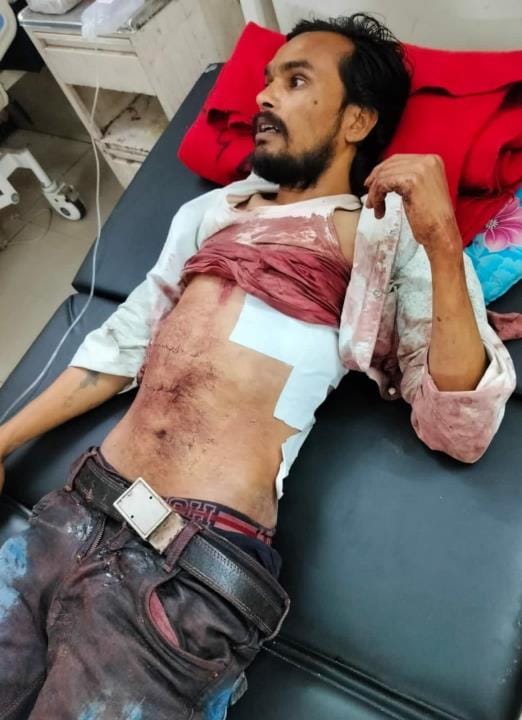 The fruit vendor was attacked with a knife