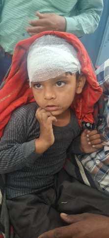 Child injured in dog attack