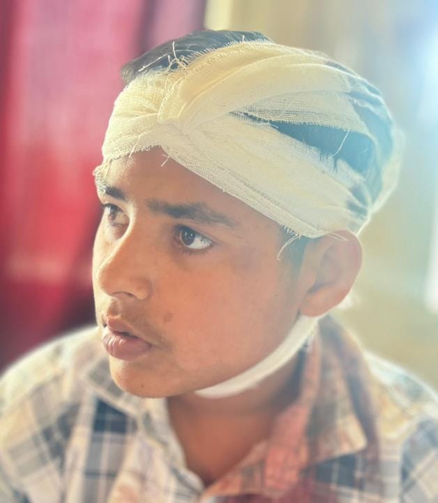 Now father and son injured in parking dispute in Jagatpura