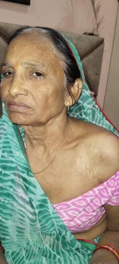 The pain of the shrapnel stuck in the shoulder still makes Dihuli's wounds fresh