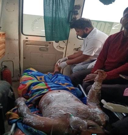 Technician grade 2 officer got burnt due to electric shock, treatment is going on
