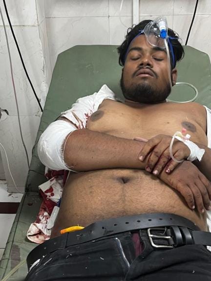 BCA student brutally beaten and shot due to enmity