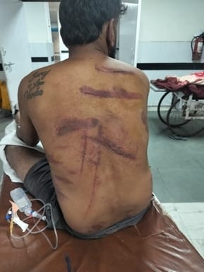 A cow injured a young man in Mahavir Mandir street