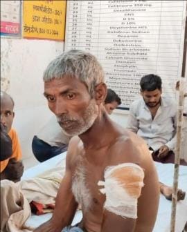 Leopard attacks a farmer who was cutting coriander in the field