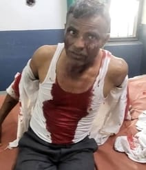 Two farmers were attacked by leopard