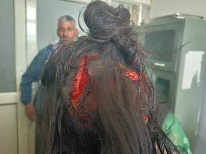 Two women who went to collect wood in the forest were attacked by a bear