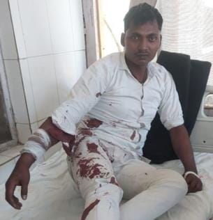 DCM driver shot by bike riding assailants