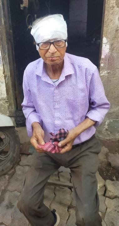 An elderly man's head broke after he fell after stumbling on uneven interlocking