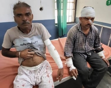 Father and son injured in leopard attack