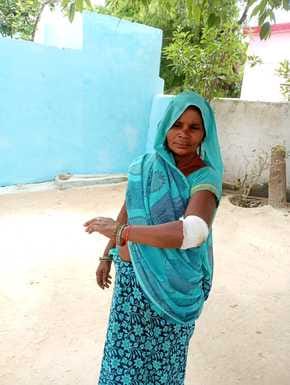 Villagers are troubled by monkey attacks in Kalyanpur Dharamai