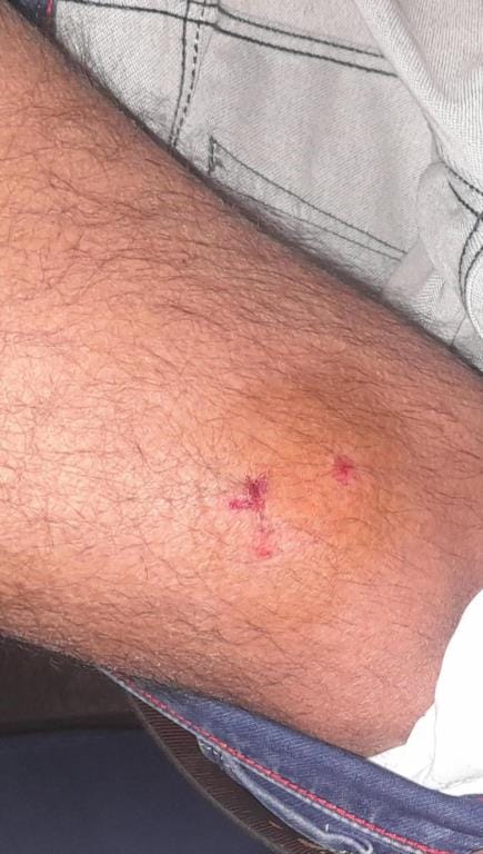 A dog bit an employee after he entered the malaria wing office, the owner argued with him