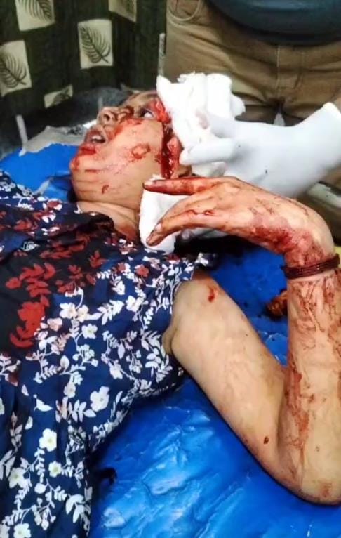 Scooty riding uncle and niece injured by Chinese string, girl critical